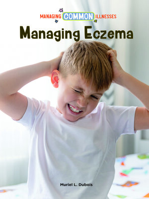 cover image of Managing Eczema